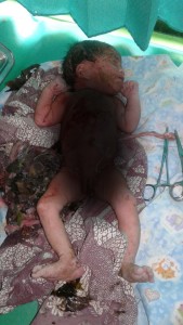 Bayi perempuan sesaat setelah ditemukan. (IST)