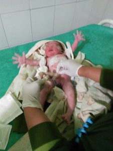 Bayi laki-laki dengan ari-ari masih melekat ditubuhnya saat ditangani oleh puskesmas batu lengir. (IST for koranmadura.com)