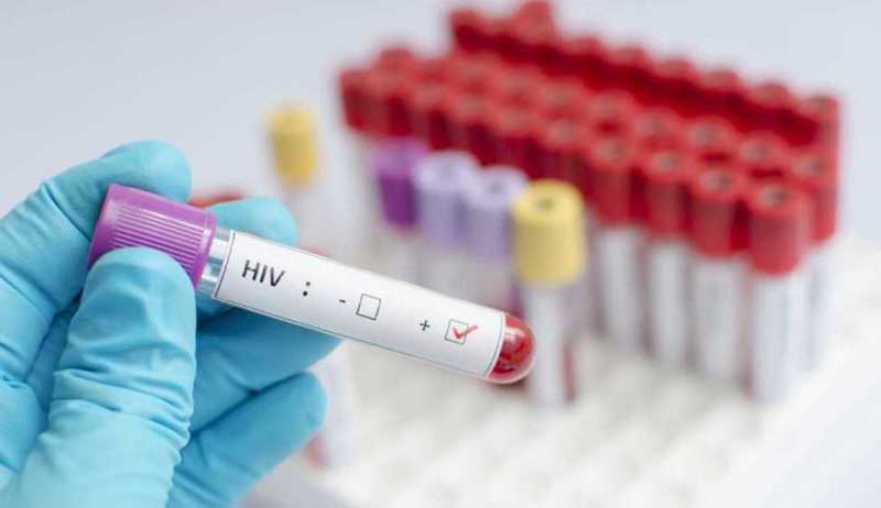 Duh, 14 Oknum Guru Tertular HIV
