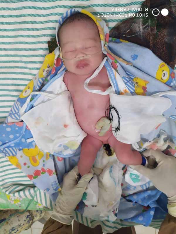 Penemuan Bayi Perempuan di Halaman Rumah Sugianto Gegerkan Warga Bangkalan